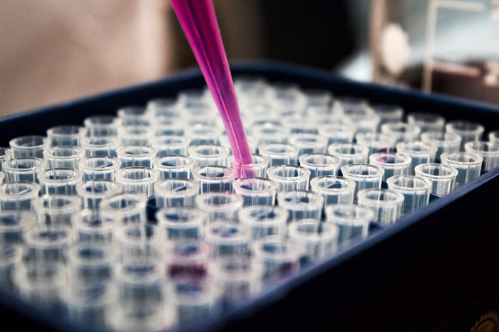 Waarom ben ik altijd moe? 5 biologische oorzaken